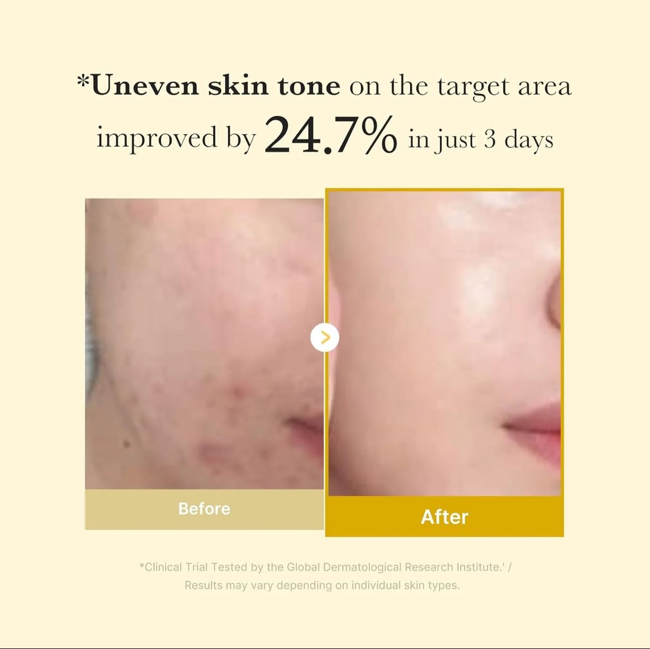 Medicube Kojic Acid Turmeric Night Wrapping Mask – (75ml)